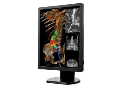 Tomosentez - Mamografi Monitörleri